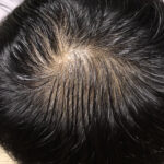 レス1番のサムネイル画像