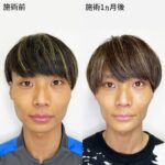 レス1番のサムネイル画像