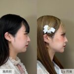 レス9番のサムネイル画像