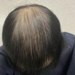 レス34番のサムネイル画像