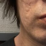 レス1番のサムネイル画像