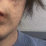 レス1番のサムネイル画像