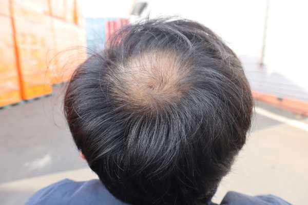 記事サムネイル