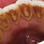 レス28番の画像1