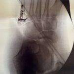 レス3番の画像1