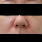 レス1番のリンク先のサムネイル画像