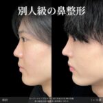 レス28番の画像1