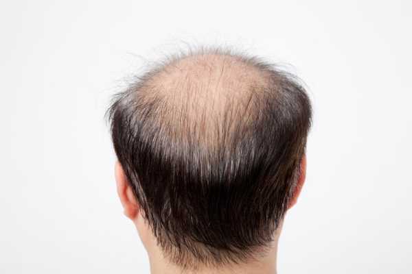 記事サムネイル