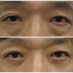 レス1番のリンク先のサムネイル画像