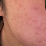 レス22番のリンク先のサムネイル画像